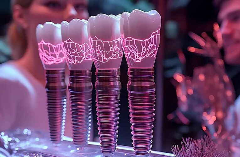 Несъемный протез на четырех имплантах: как понять стоимость лечения в Украине