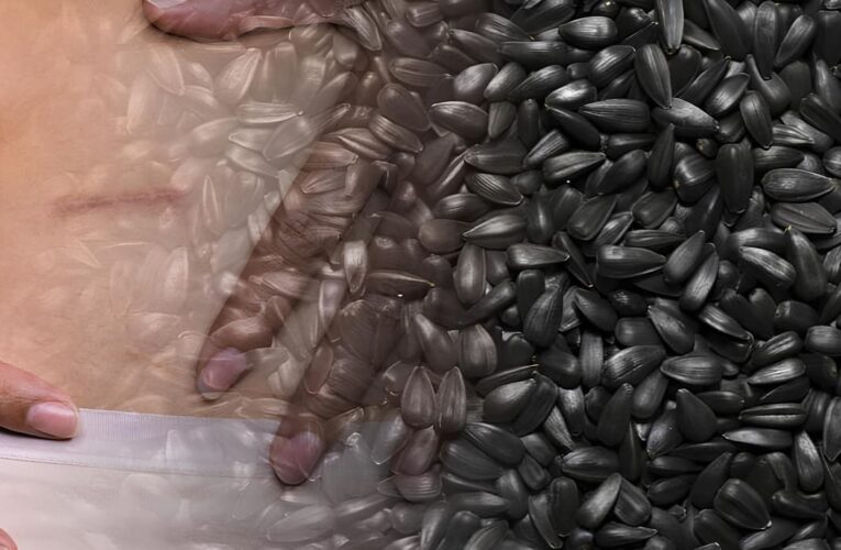 Правда ли, что чипсы, семечки и орехи вызывают аппендицит?